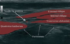 �����_�o��ۯ�,�_�o��ۯ�,����޲��,����,�摜